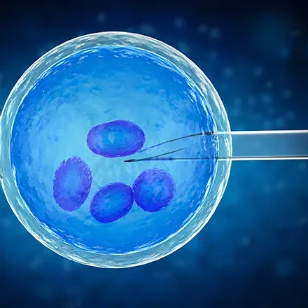 Inseminacion Artificial